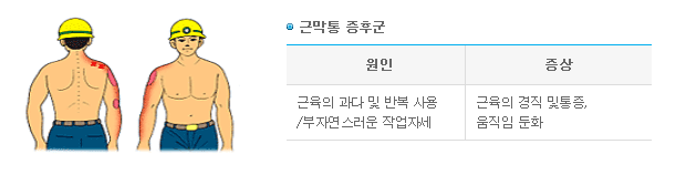 근막통 증후군 -> 1.원인-근육의 과다 및 반복 사용/부자연스러운 작업자세 2.증상-근육의 경직 및 통증, 움직임 둔화