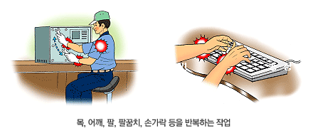 목, 어깨, 팔, 팔꿈치, 손가락 등을 반복하는 작업